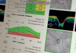 Díky daru nadačního fondu pořídila Litomyšlská nemocnice vyšší verzi programu pro oční oddělení