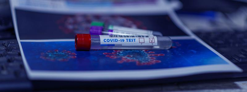 Nemocnice Pardubického kraje spouští on-line rezervační systém pro odběrová místa na koronavirus